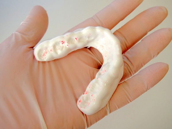 スポーツマウスピースは歯科医師が調整・東京都港区麻布十番